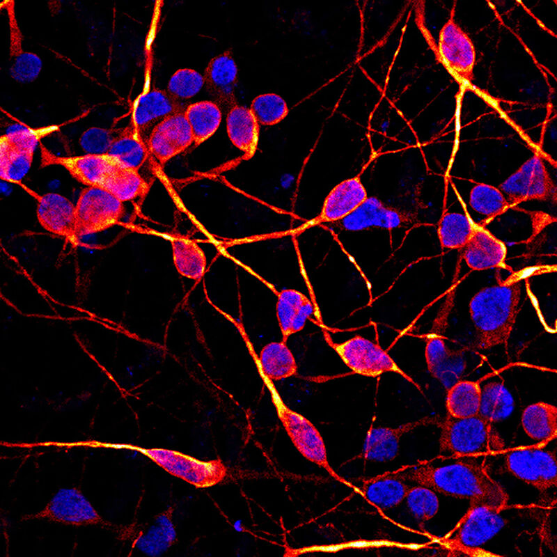 Zur Erforschung neurodegenerativer Erkrankungen wie ALS und Parkinson werden Stammzellen (iPS-Zellen) genutzt. (Foto: CRTD)