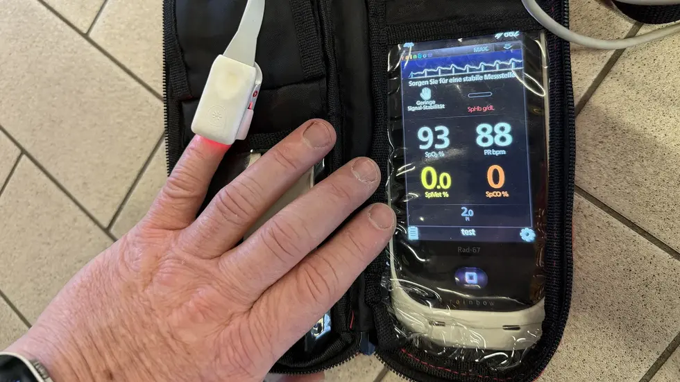 Durch die Einsatzkräfte wurden bei allen Betroffenen Messungen mit einem
speziellen CO-Messgerät durchgeführt.